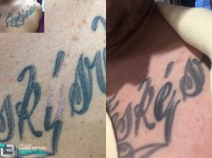 Like some of your ink… but not ALL of it? Keep what you want and say good-bye to the rest.
